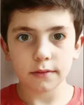 Digital Therapy for Intermittent Strabismus