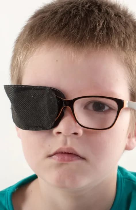 التغطية (اللاصق)