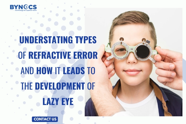 Razumevanje vrst refrakcijske napake in kako vodi do razvoja lenega očesa
