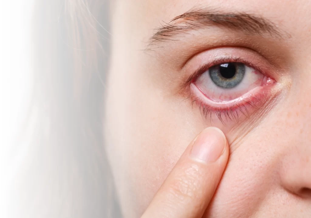 Liječenje suhih očiju